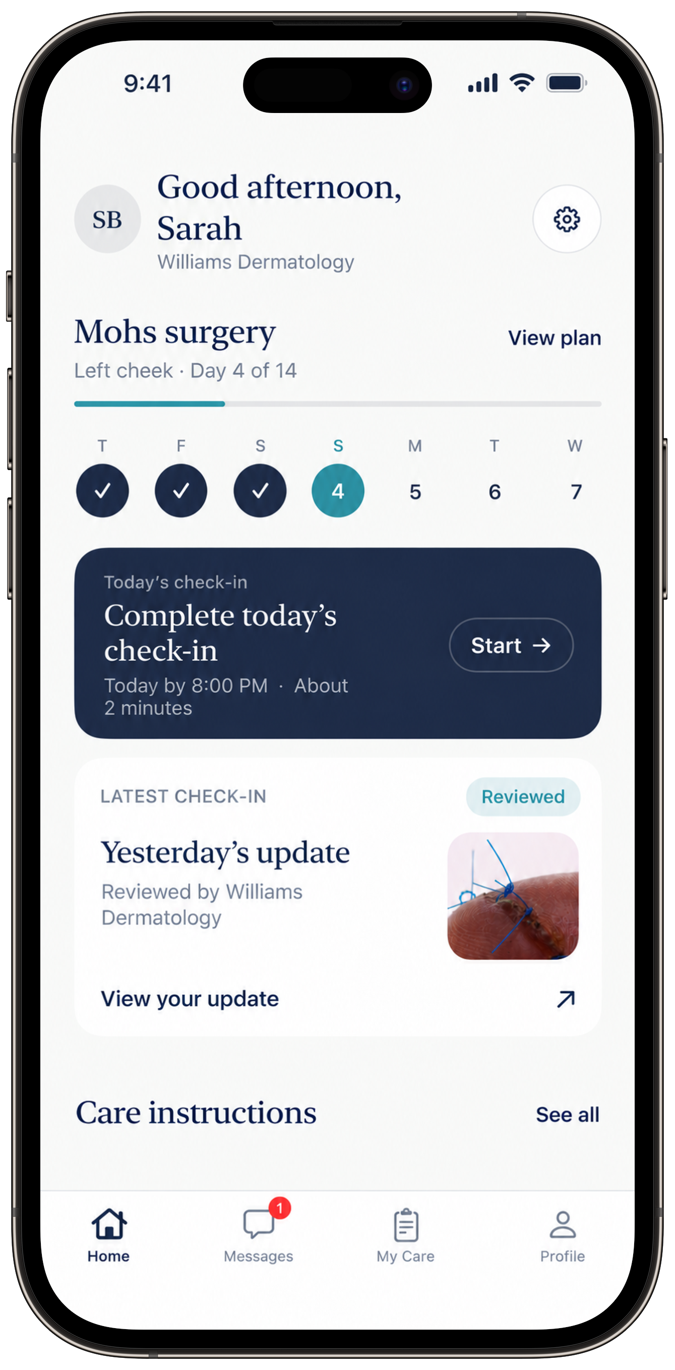 Soliana Health recovery dashboard on an iPhone, showing a Mohs surgery care plan, today’s check-in, and a reviewed patient update